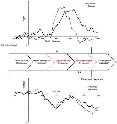 Association between physical health and neurocognition in first-episode schizophrenia